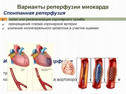 Реканализация это