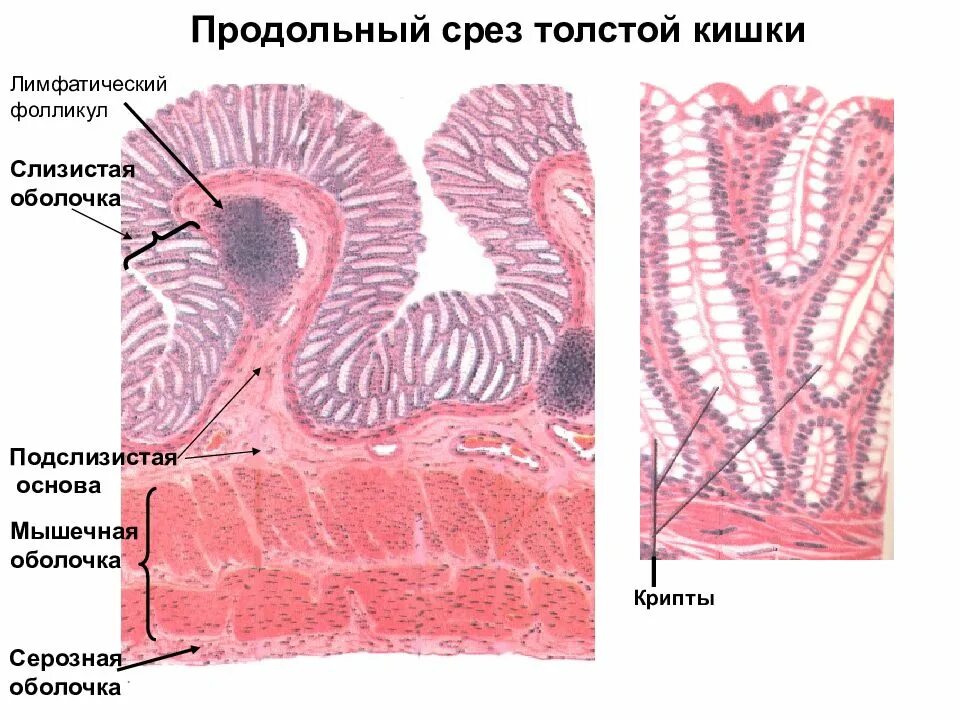 Кишечник гистология. Слизистая оболочка толстой кишки гистология. строение стенки толстого кишечника. срез стенки толстой кишки. нормальная слизистая толстой кишки гистология.
