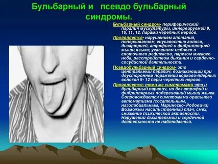 Обонятельные галлюцинации наблюдаются