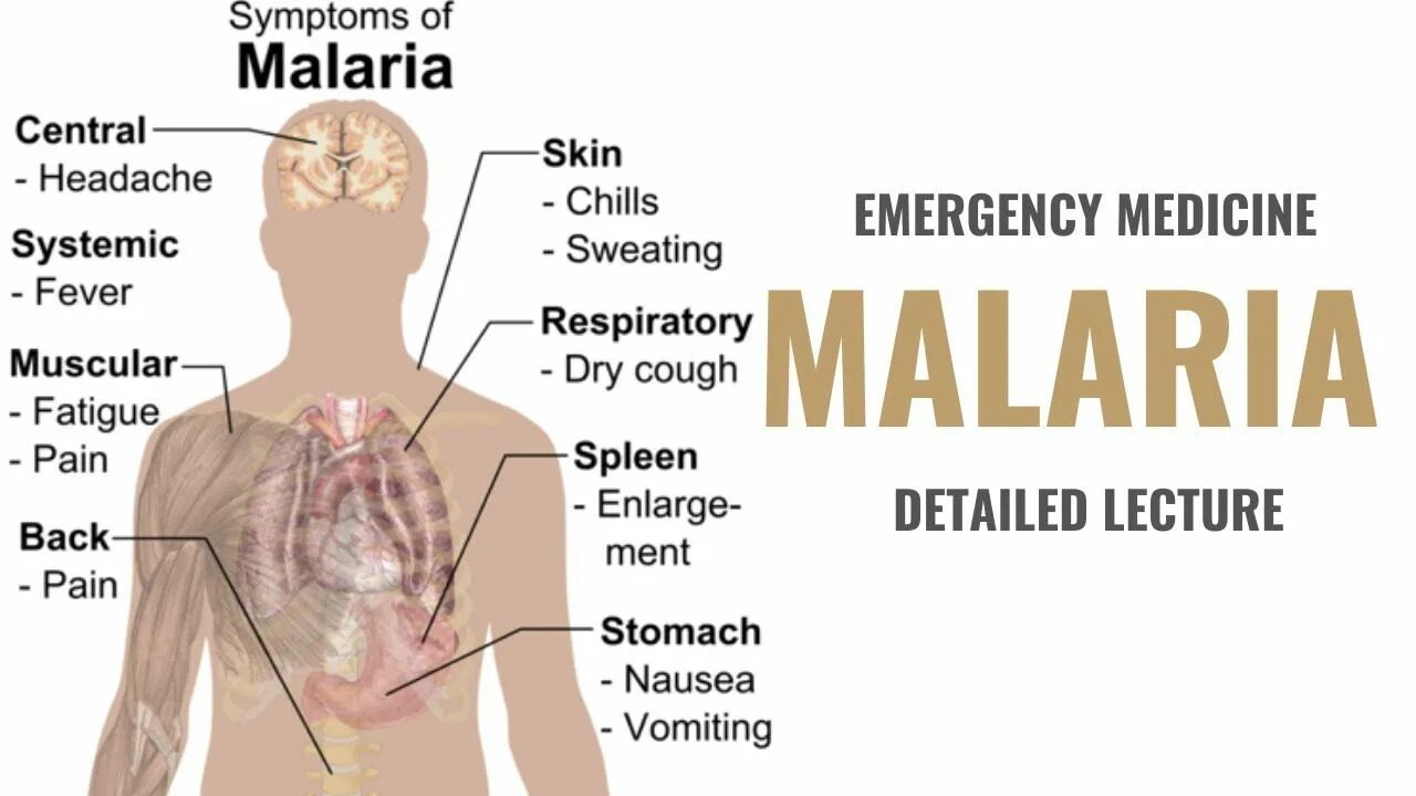 Клинические проявления малярии.