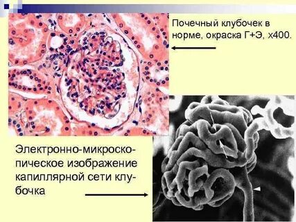Капиллярный клубочек почки