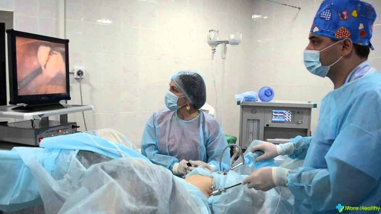 Беременность и роды при экстрагенитальной патологии. Шов от кесорево сечения. Шрам после кесарево сечения. Лапароскопия миомэктомия. Забеременеть после операции.