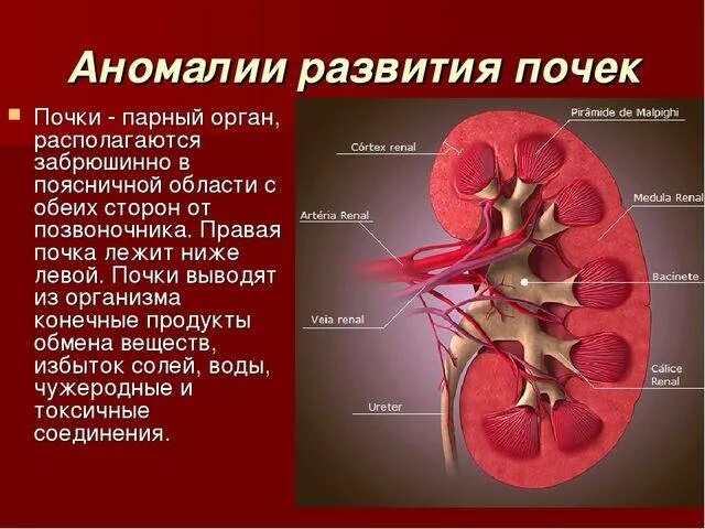 Изменение левой почки. Аномальное строение почки. Аномалии структуры почек. Аномалии развития ЧЛС почек. Аномалия формы строения почек.