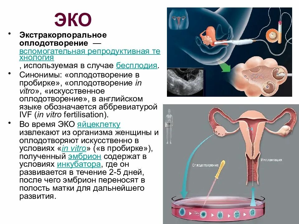 Экстракорпоральное оплодотворение. Эко экстракорпоральное оплодотворение. Эко это искусственное оплодотворение. Искусстсвенноеоплодотворение.