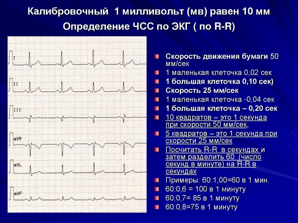 В каких условиях необходимо проводить исследование экг