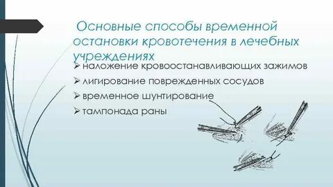 Лигирование сосудов это