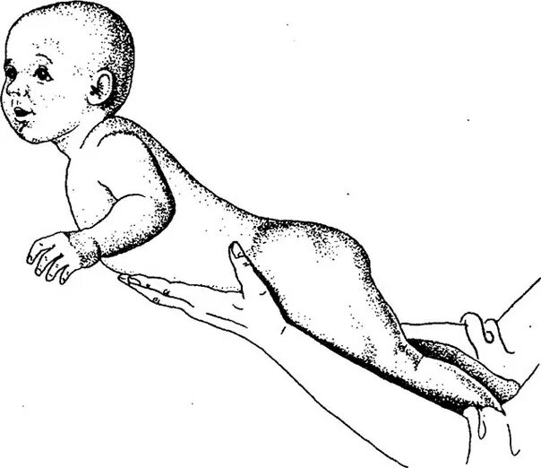 Рефлекторные упражнения для грудничков. Упражнение парение на животе. Рефлекторное разгибание позвоночника для новорожденных. Упражнение присаживание.