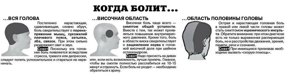 Каждый день болит голова что делать. Головная юоль в вичках. Болит в висках причины. Головная боль в затылке и висках. Головная боль в висках причины.