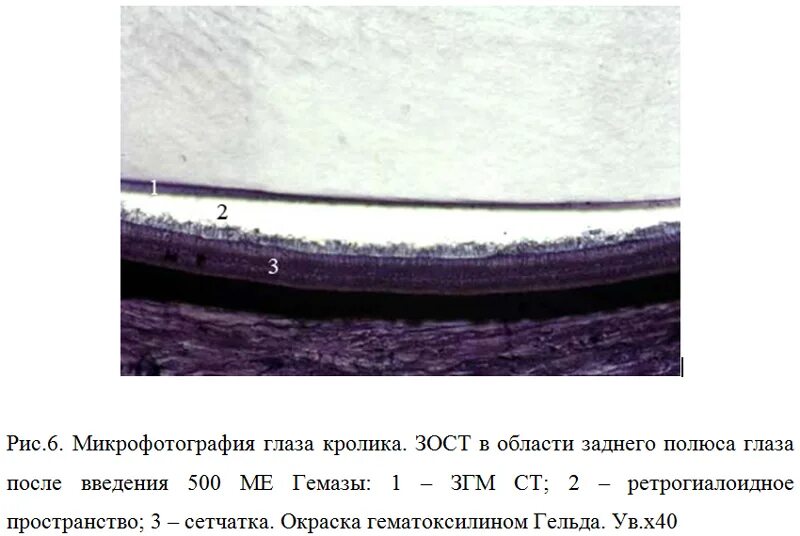 Задний полюс глаза. Задняя гиалоидная мембрана.