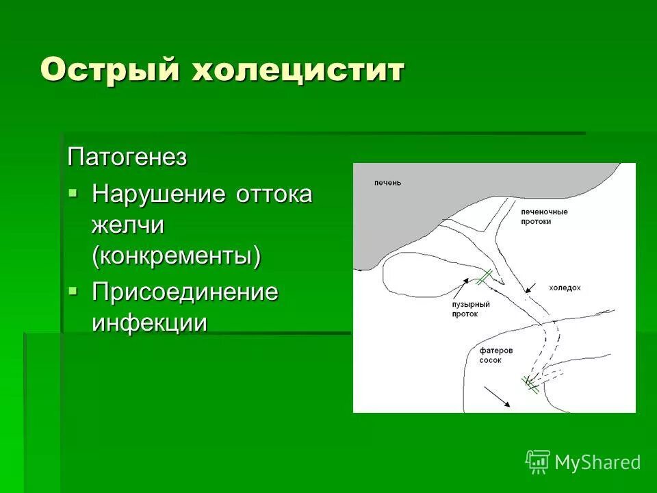 Отток желчи на боку