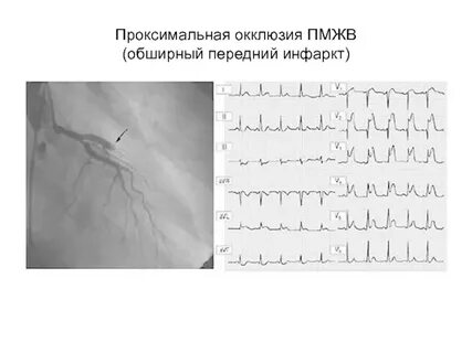 Ш рстка тяж лый защ лка