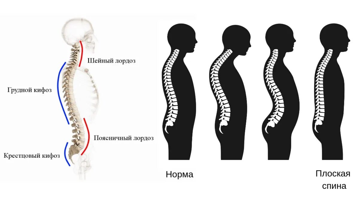 Позвоночник человека лордоз кифоз. Кифоз лордоз грудного отдела позвоночника. Искривление грудного отдела позвоночника кифоз. Изгибы позвоночника лордоз и кифоз. Естественные изгибы позвоночника