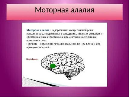 Моторная афазия алалия