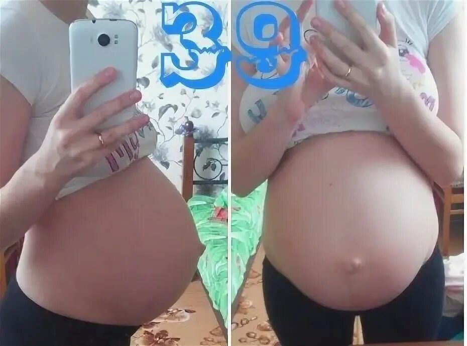 39 неделя беременности можно. Опущение живота на 39 неделе. живот у первородящих и повторнородящих. живот на 39 неделе беременности. 38 недель 2 беременность.
