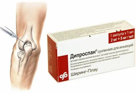 Укол в колено как правильно