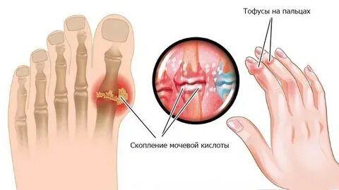 Болит кисть ноги