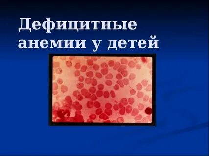 Анемия пятна