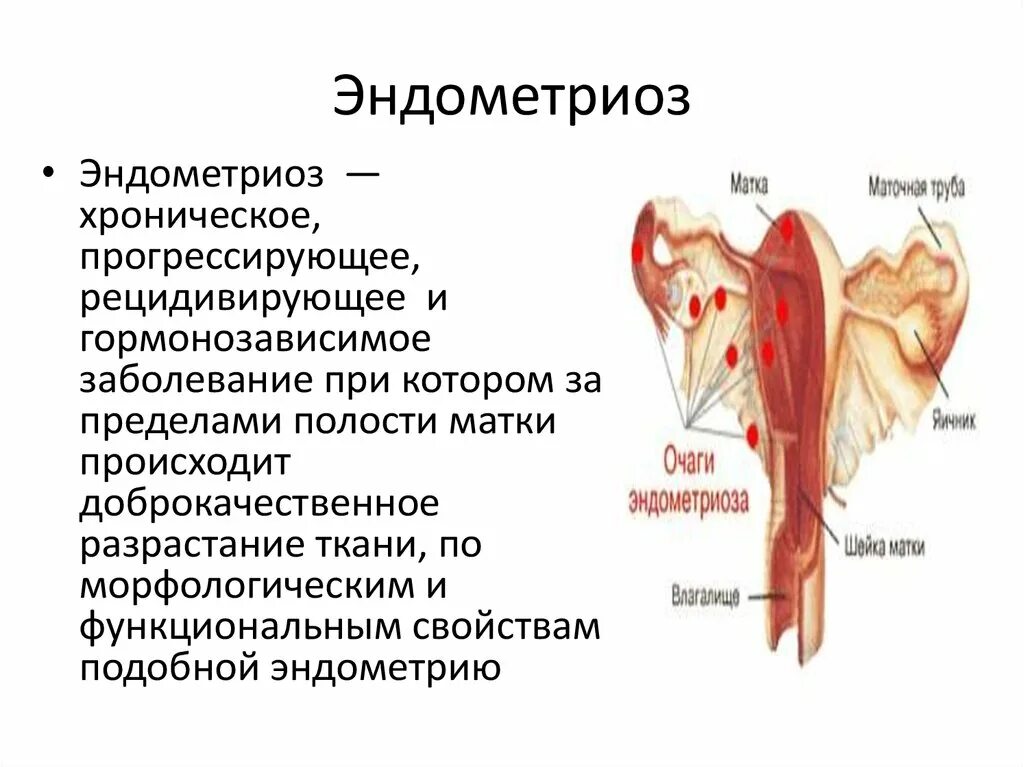 Психосоматика эндометриоза матки. Эндометриоз маточных труб клиника. Эндометриоз инкубационный период.