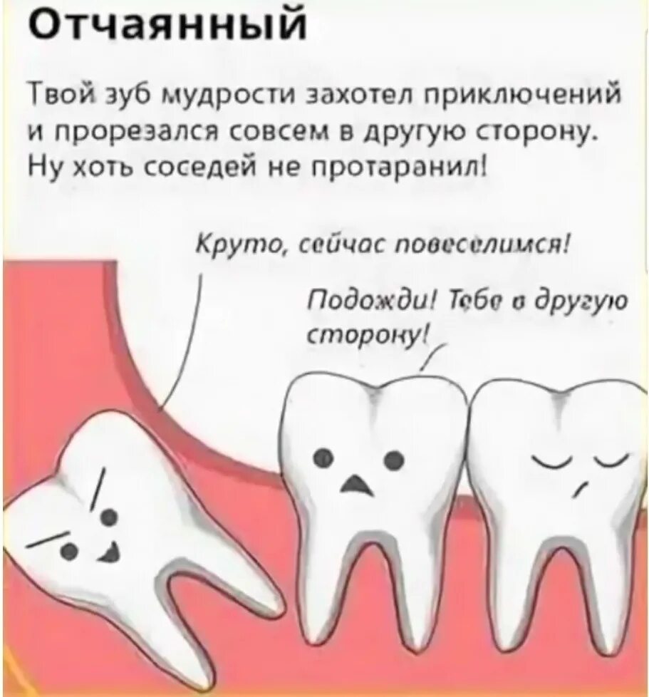 Лечат 8 зуб. Неправильное положение зуба мудрости. Зубная боль зуб мудрости.