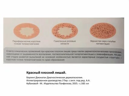 Герпес погибает при температуре
