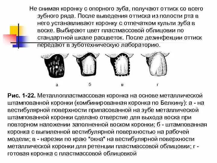 Коронка по белкину препарирование. Металлопластмассовая коронка по белкину. Препарирование штампованными коронками. Препарирование под коронку. Комбинированная штампованная коронка.