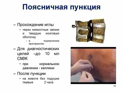 Через сколько после пункции