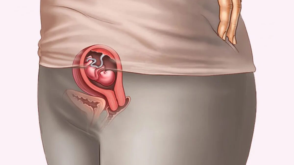 9 неделя даты. Эмбрион на 9 неделе беременности. Размер эмбриона на 9 неделе беременности. Эмбрион в 8-9 недель беременности. Плод ребенка на 8-9 неделе беременности.