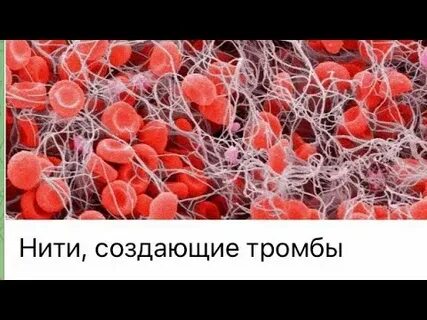 Тромб мем