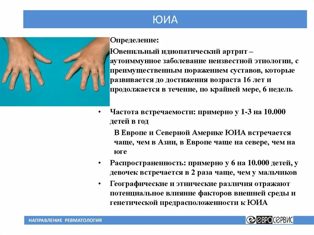 Артрит это аутоиммунное заболевание. Принципы выявления и терапии аутоиммунных заболеваний. Ревматоидный артрит презентация. Аутоиммунное ревматоидное заболевание. Аутоиммуное воспалителельное заболевание.