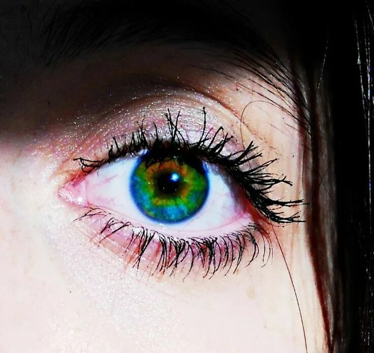 Радиальная гетерохромия. Гетерофромия зелёные глаза. Спектральная гетерохромия. Гетерохромия карие. Different eye