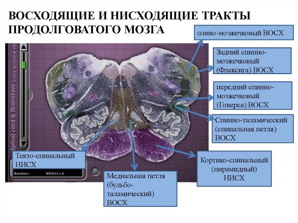 Тракты мозга