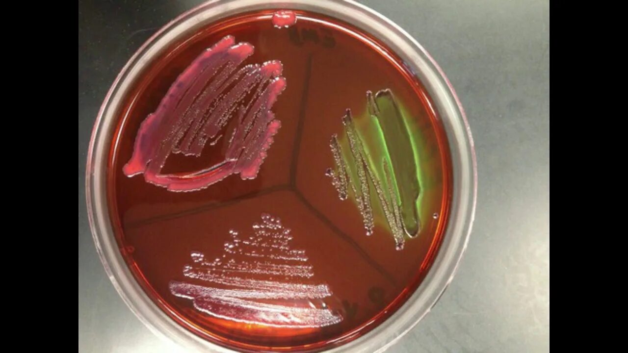 Ба агар. Агар Плоскирева сальмонелла. E coli на среде Левина. Агар Симмонса шигеллы. Агар Левина сальмонелла.