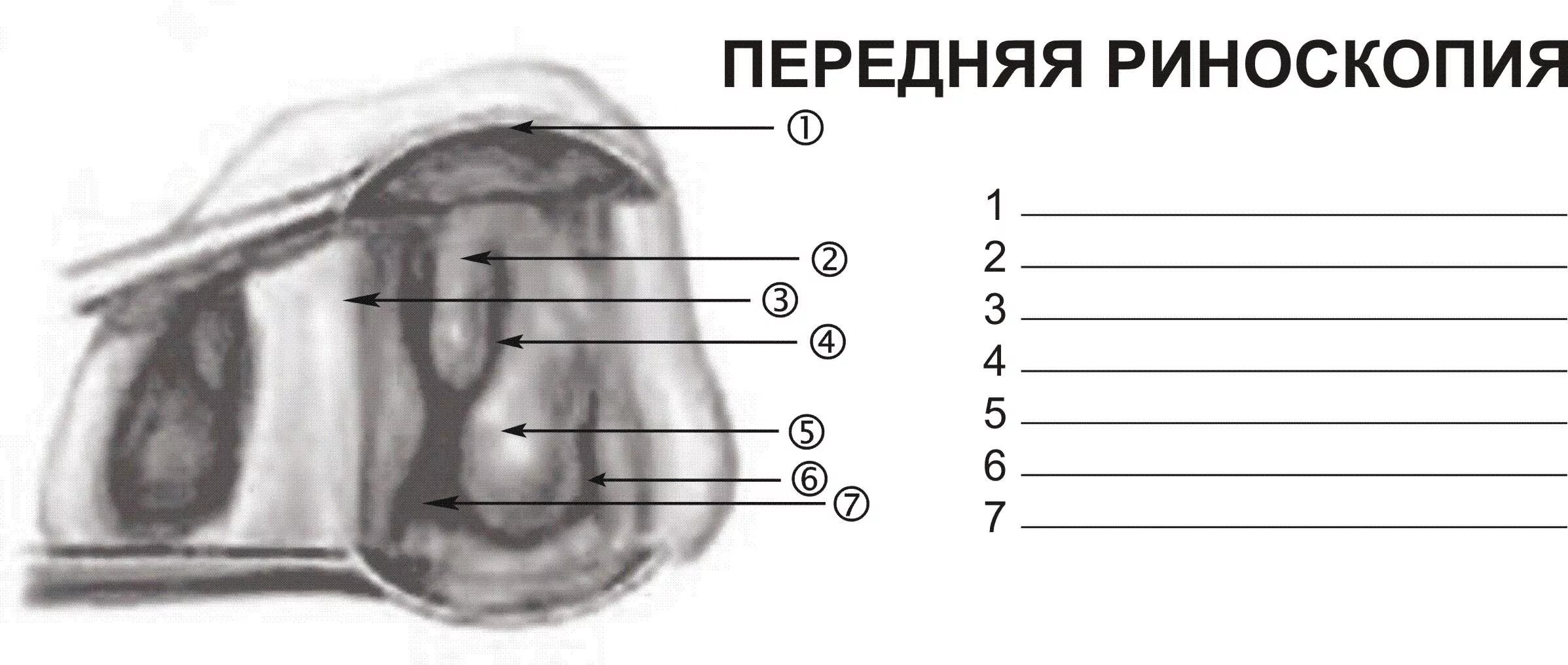 Осмотр носовых ходов
