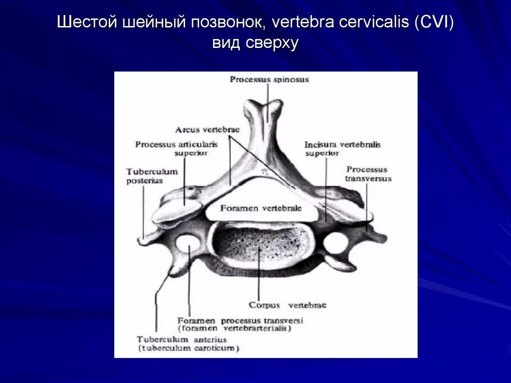 Сонный бугорок vi шейного позвонка - tuberculum caroticum. Шестой шейный позвонок вид сбоку. Анатомия с6 позвонка. 6 Шейный позвонок вид сбоку. Характерные признаки шейного позвонка