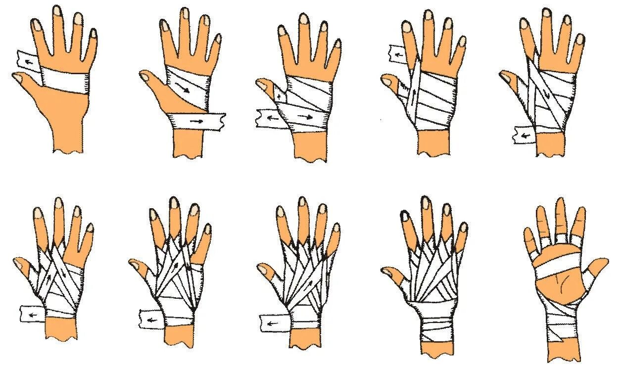 Как перевязать палец на руке. Схема бинтования рук в боксе. Перевязка кисти эластичным бинтом. Бинтование кисть бинтом. Схема бинтования руки боксерскими бинтами.