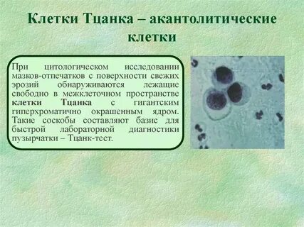 Метод мазков отпечатков