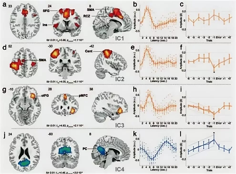 Частота головного мозга человека в Герцах. Диаграмма работы мозга. Как называется сканирование активности мозга. 1 Атомарный уровень сканирование мозга.
