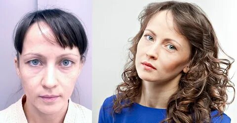 Всероссийский пластический глазной