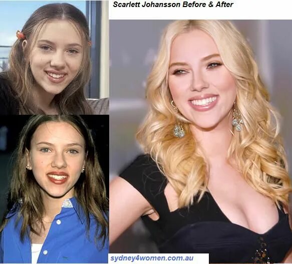 Скарлетт йоханссон губы до и после пластики Scarlett Johansson, Before and After Actress without makeup, Inspirational celeb