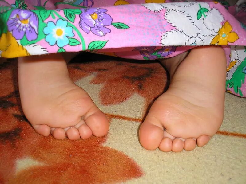 у ребенка пожелтели стопы