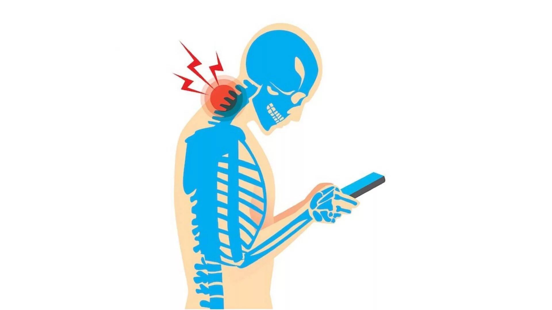 Человек с остеохондрозом. Гаджеты и позвоночник. Боль в спине вектор. Текстовая шея.