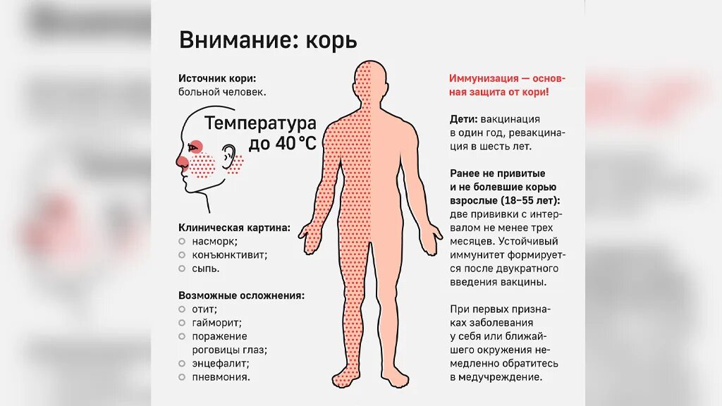Корь привитых симптомы. Корь у детей информация симптомы. корь у детей информация для родителей симптомы. корь краснуха ветряная скарлатина.