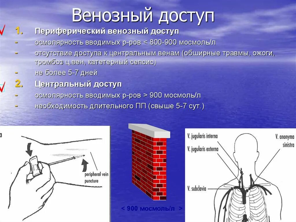 Центральные и периферические вены. Места постановки периферического катетера. Периферия венозная. Кубитальный периферический катетер. Периферия венозная.