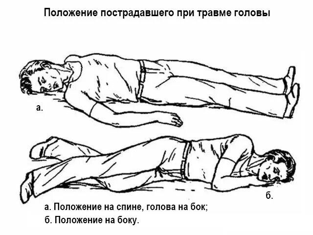 Положение при ранении головы. Транспортировка пострадавшего при ранении головы. положение при переломе черепа. транспортировка пострадавшего при переломе черепа. положение пациента при чмт.