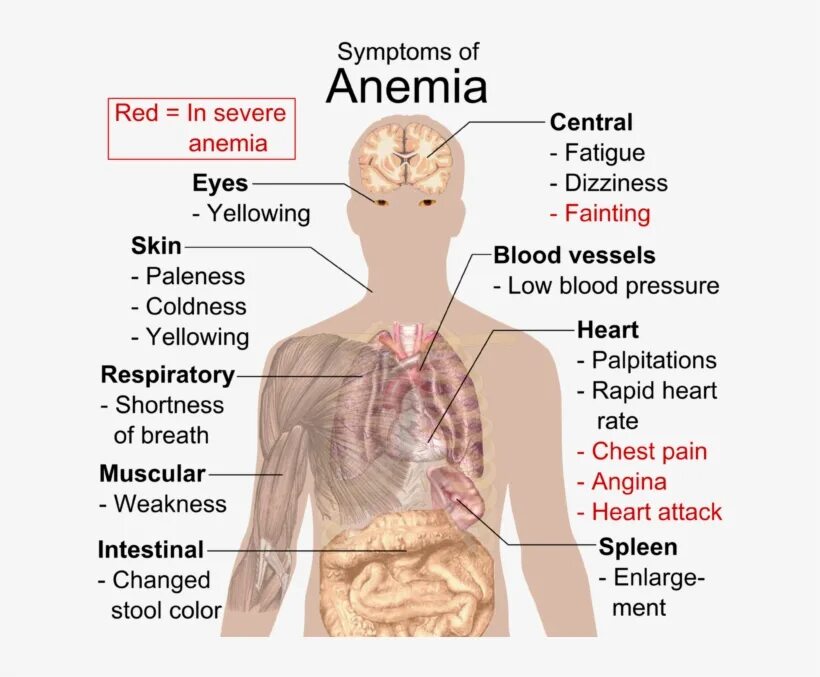 Анемия и вес. Симптомы низкого ферритина. Болезни крови симптомы. Клиническая картина анемии.