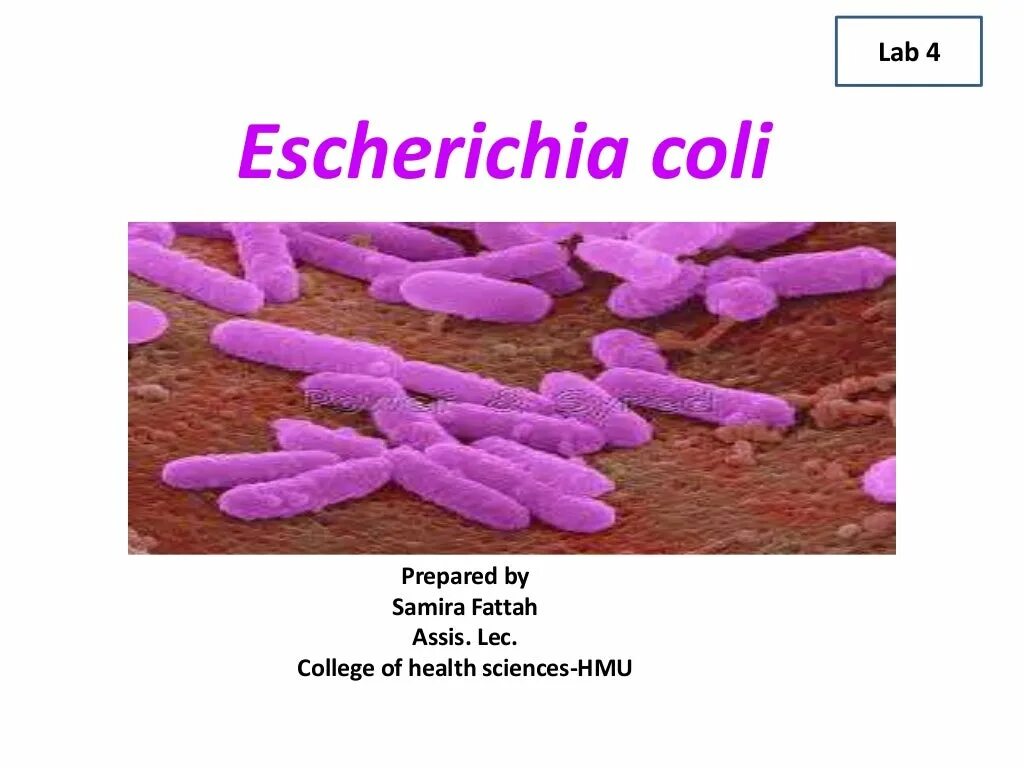 Бактерия Escherichia коли гемолитическая. Морфология эшерихии коли. Эшерихии иммунитет. Эшерихия коли симптомы. Escherichia coli что это у мужчин