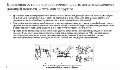 Наложение повязки при кровотечении алгоритм