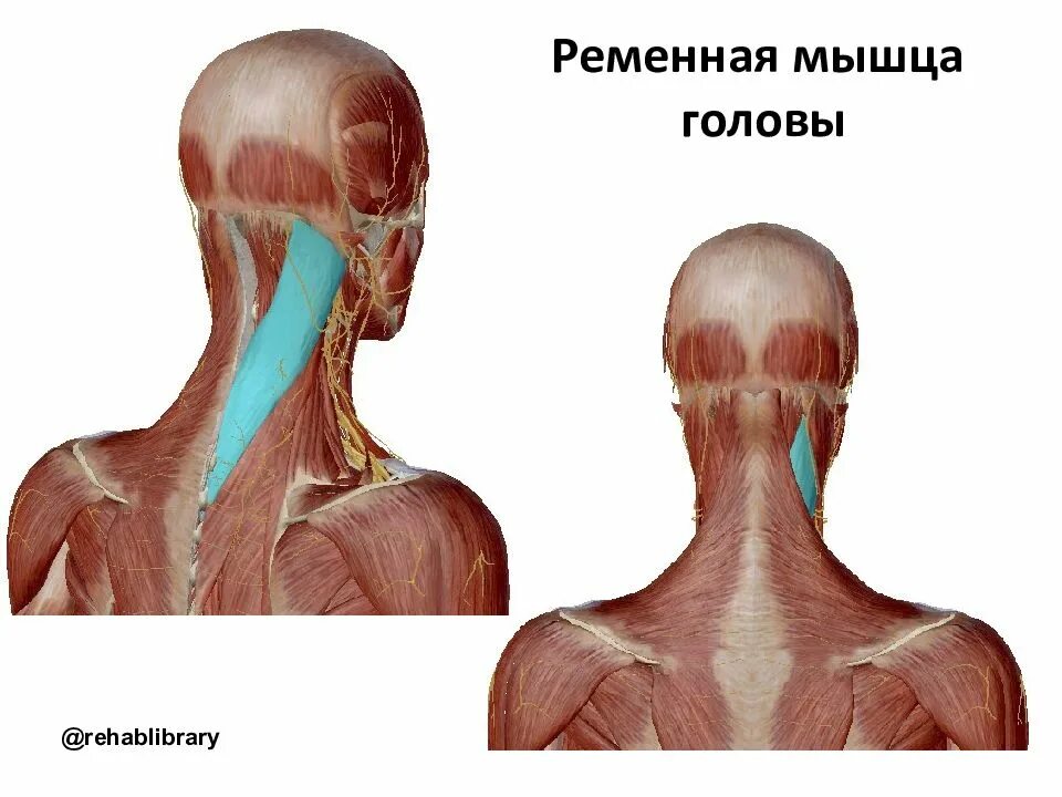 Ременная мышца головы и шеи. Ременная мышца головы. Ременная мышца шеи.