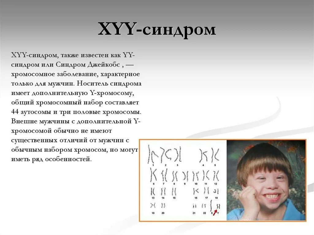 XYY синдром. Полисомия по у-хромосоме. XYY хромосомы синдром. Болезнь с лишней хромосомой