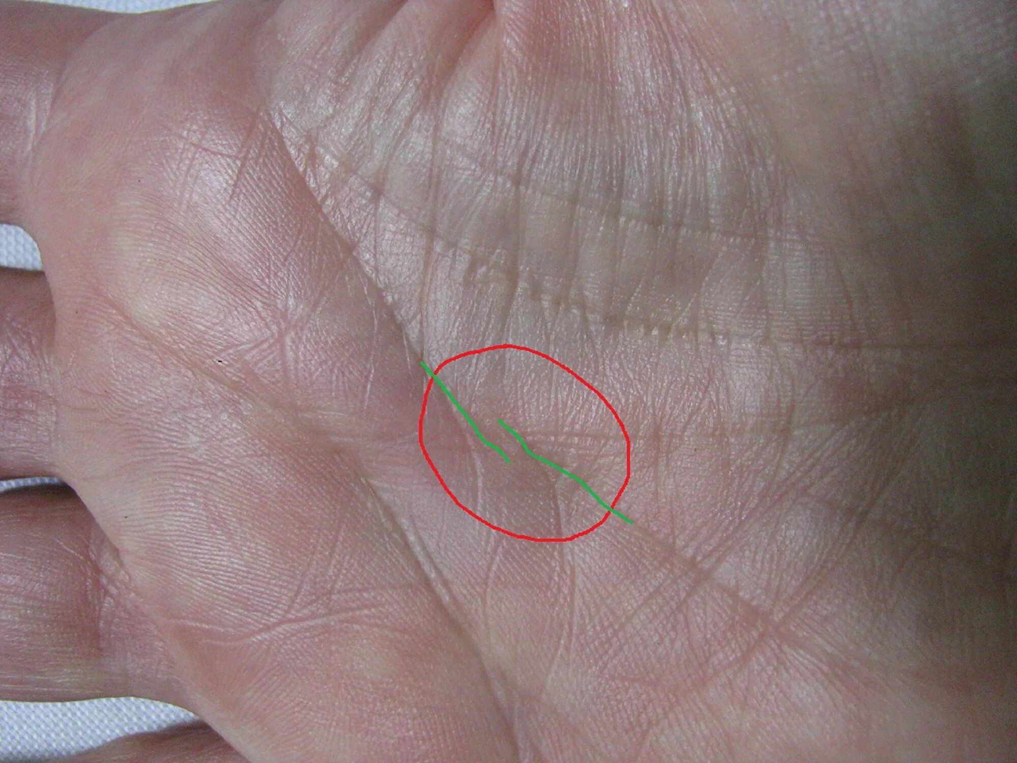 хиромантия остров. хиромантия остров на линии судьбы. хиромантия остров на линии жизни. линия жизни на ладони остров. хиромантия остров.